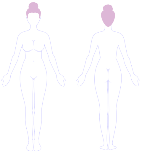 Laser ontharen vrouwen